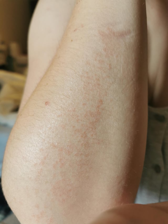Arms