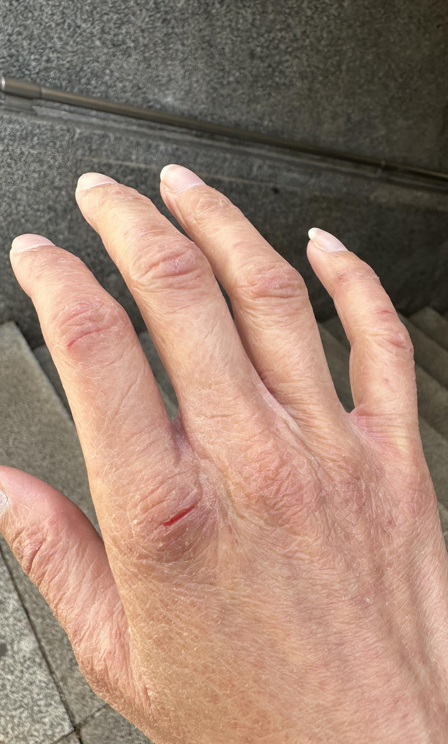 Hands