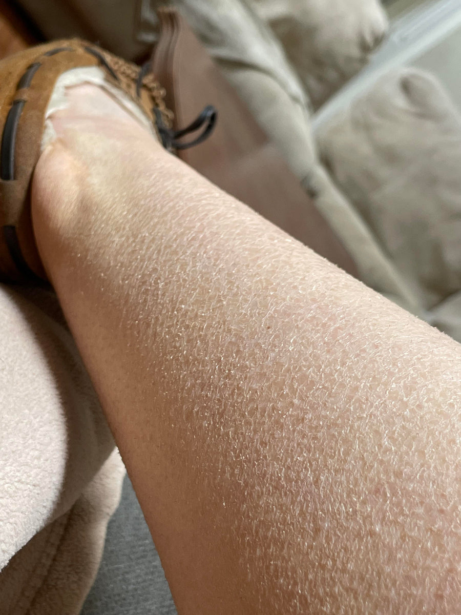 Legs